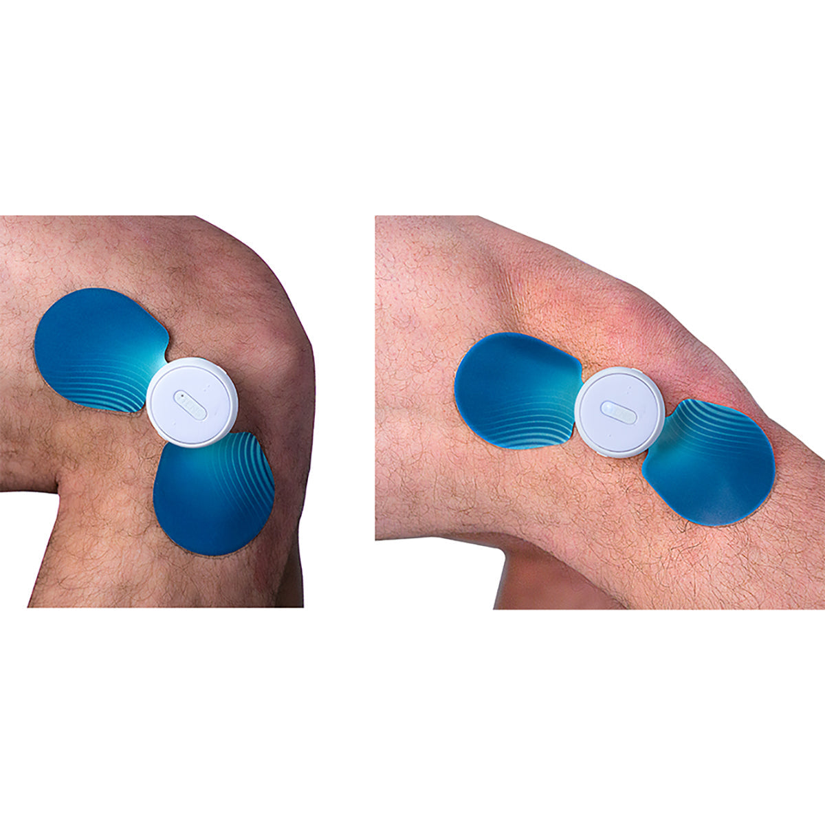 iTens Wearable Electrotherapy