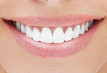 Healthy Gum Professional Teeth Whitening System
