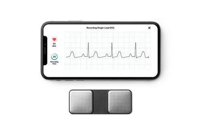 Portable EKG